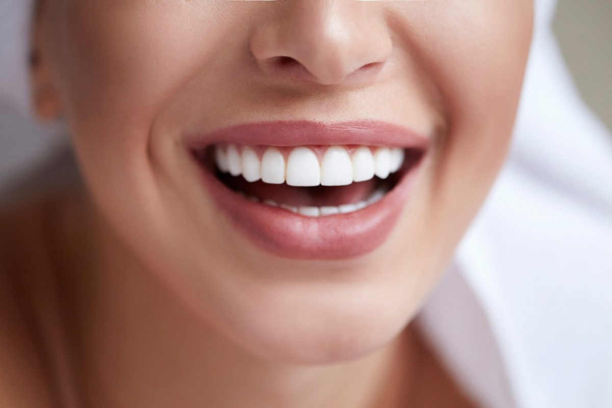 Make Your Porcelain Veneers Last By Taking These Four Simple Steps