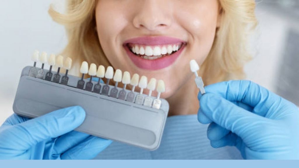 What To Consider When Selecting The Best Veneer Dentist