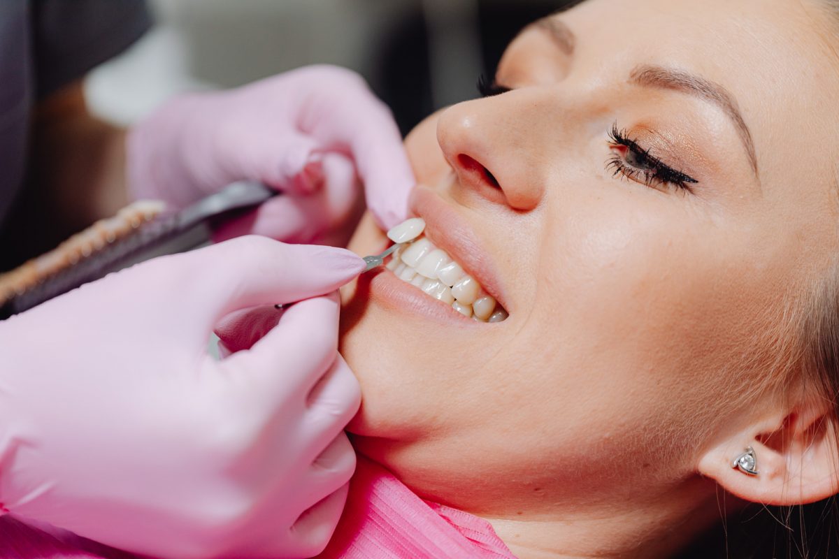 Veneers being installed into a woman's teeth