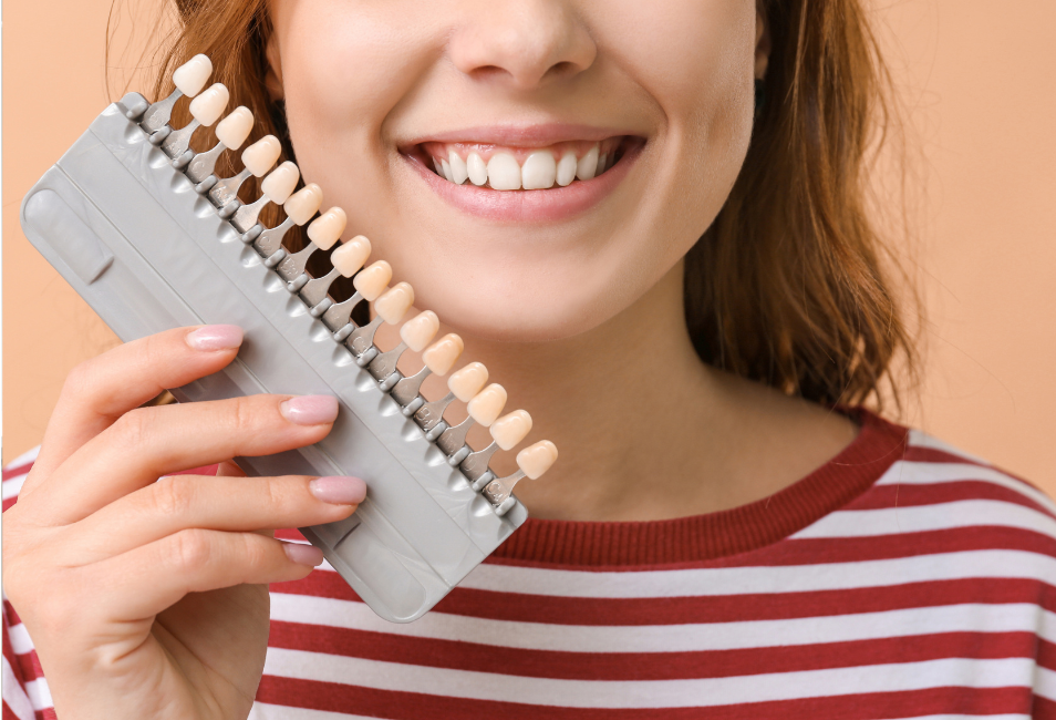 Unlock Your Best Smile this Holiday Season with Dental Veneers