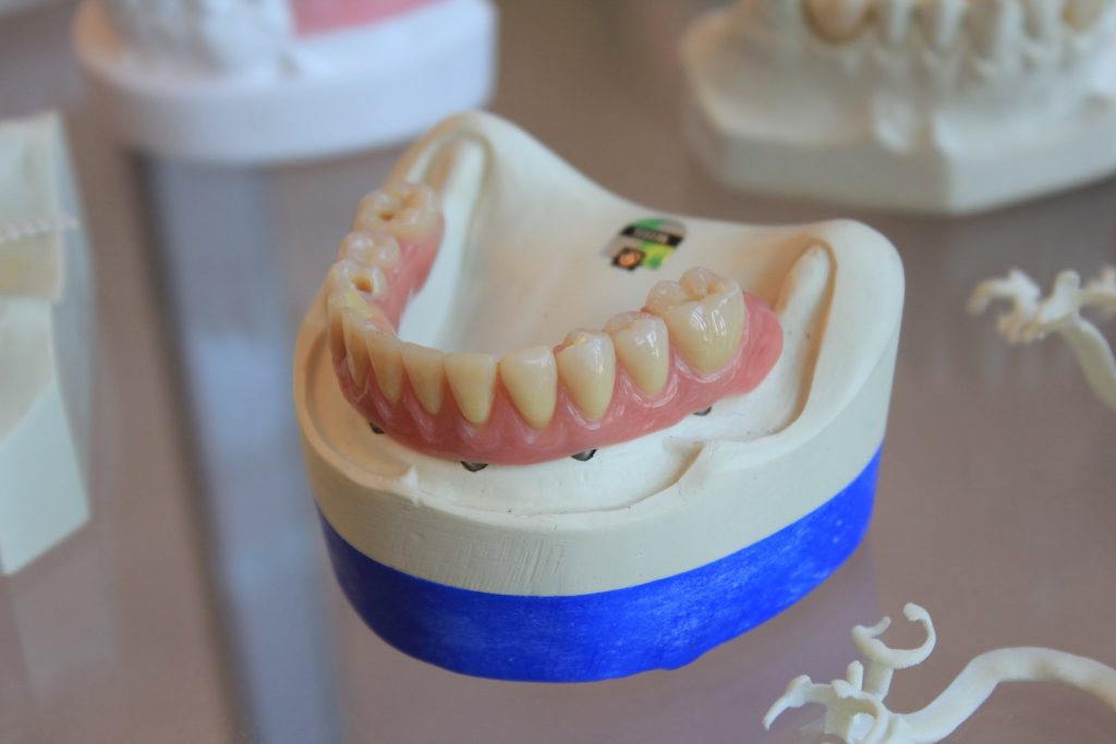 Affordable Solutions for Dentures in Paddington: Quality Care Without Breaking the Bank
