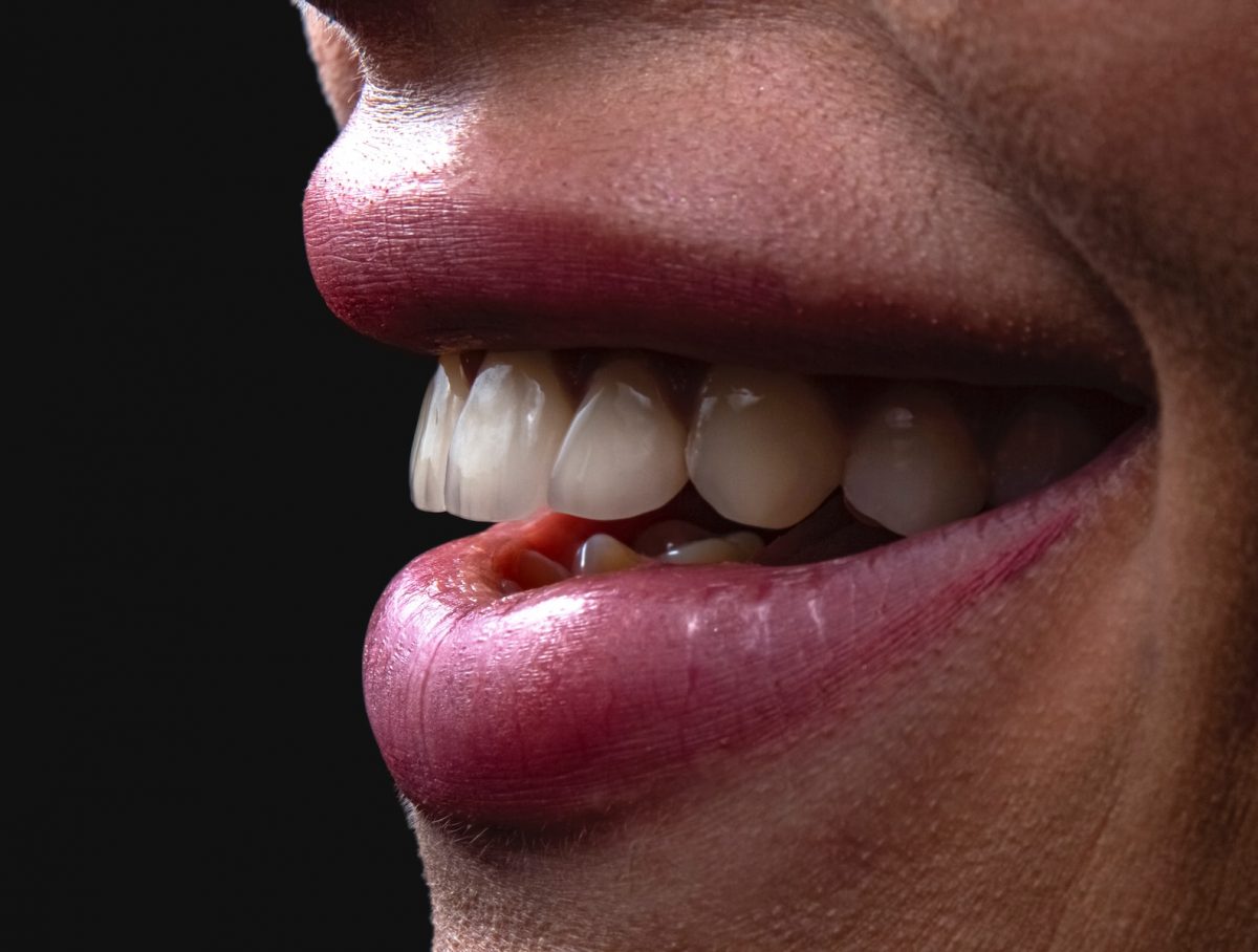 Porcelain Dental Veneers: A Simple Solution for Many Smile Problems